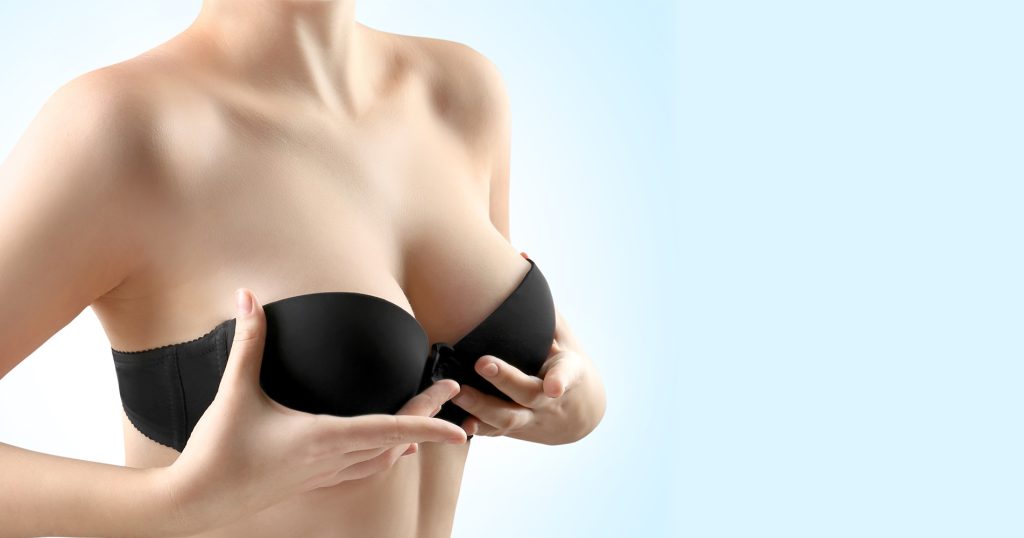 breast lift without implants before and after